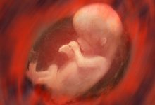 Фото - Врачи обнаружили, что замороженные эмбрионы на 74% повышают риск гипертонии у женщины