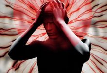 Фото - Из-за чего возникает мигрень — возможно, причина в аномалиях мозга
