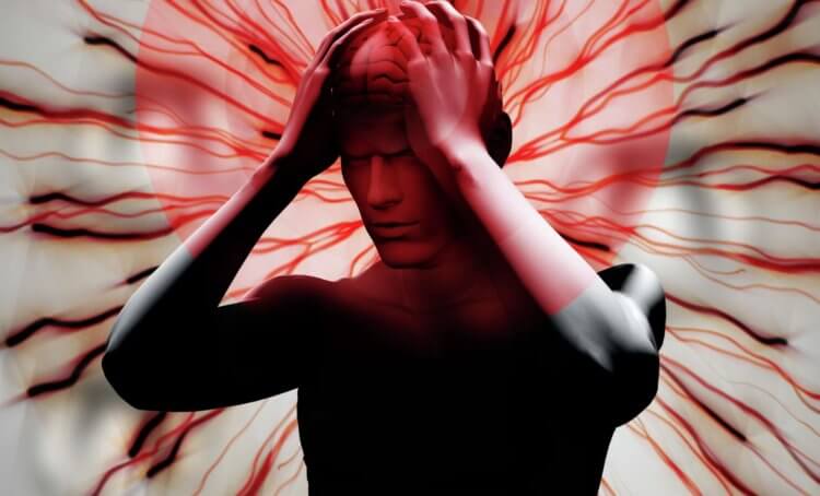 Фото - Из-за чего возникает мигрень — возможно, причина в аномалиях мозга
